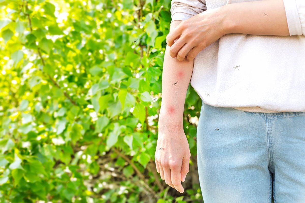 Unbelievable Hacks for Keeping Mosquitoes Away